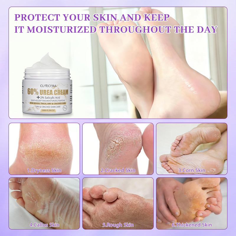 5-in-1 60% Urea Cream with 2% Salicylic Acid, Urea Cream 60 Percent for Feet & Hands- Maximum Strength Moisturizer for Rough, Dry, Thick & Cracked Skin, Callus Remover, Deep Hydration, 150g - BeesActive Australia