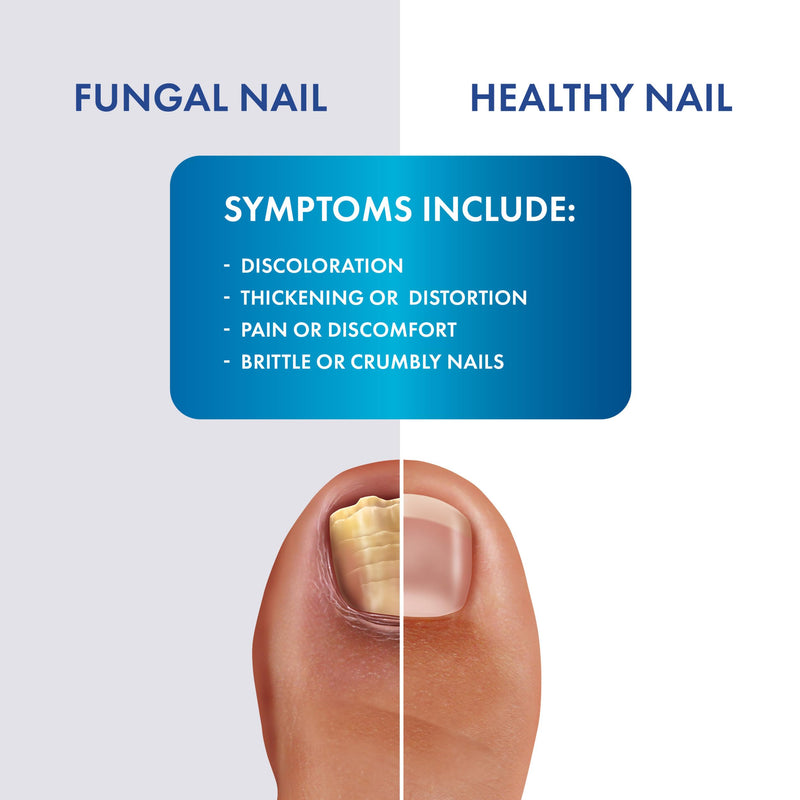 Fungal Shield Maximum Strength Brush-On Anti-Fungal Liquid, 1 Ounce Bottle (Pack of 2) - BeesActive Australia