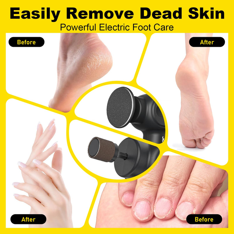 Electric Foot Callus Remover Rechargeable, Electronic Foot File Pedicure Tool, 2 in 1 Foot Grinder, Pro Foot Scrubber Kit for Dead, Hard, Cracked Skin, with 6 Speeds & 20 Sandpaper Discs - BeesActive Australia