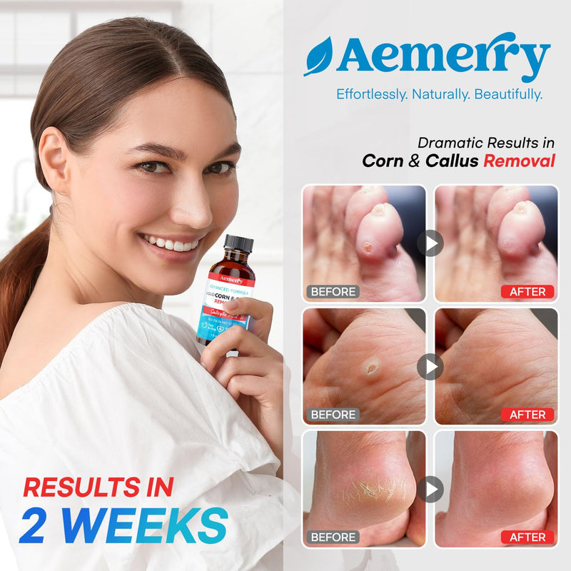 Corn Removers for Toes Foot: Liquid Salicylic Acid 17% Corns Calluses Removal Extra Strength, Fast Acting Corn Remover for Feet Fingers. 30ml Vanilla 1 Ounce - BeesActive Australia