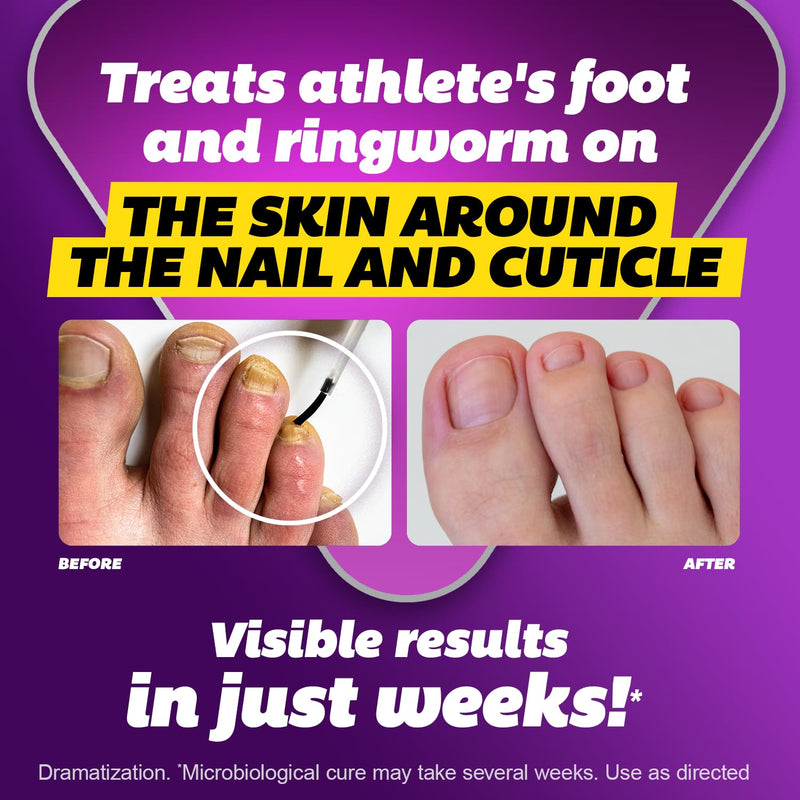 SILKA Max Strength Antifungal Liquid for Toenail Health with Brush Applicator, Results in 1 Week, Nail Fungus Treatment for Damaged Toenails, Athlete's Foot Treatment, Tolnaftate 1% 0.45 Fl Oz 0.45 Ounce (Pack of 1) - BeesActive Australia