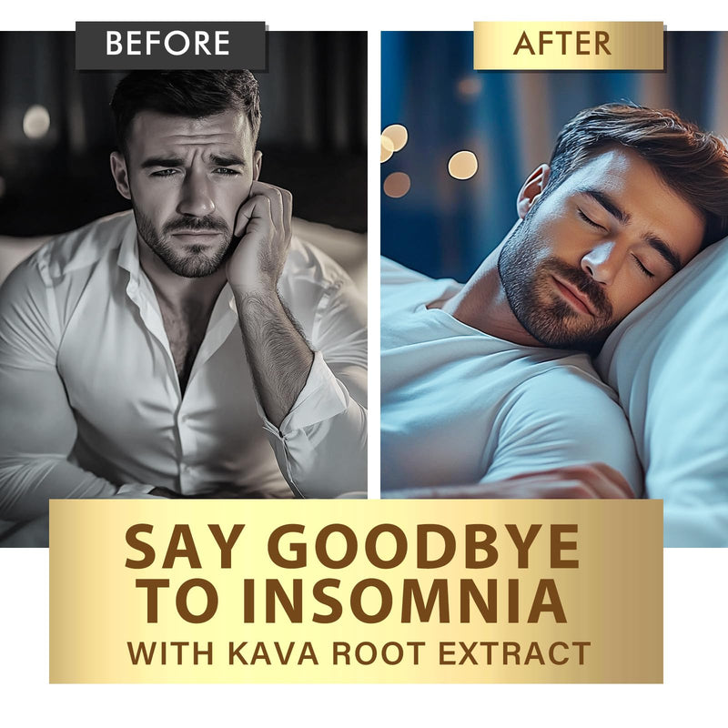Kava Kava Capsules, High Concentration Kava Root Extract Supplement for Relaxation and Immune Support, Vegan & Non-GMO, 120 Capsules 1 Count (Pack of 1)