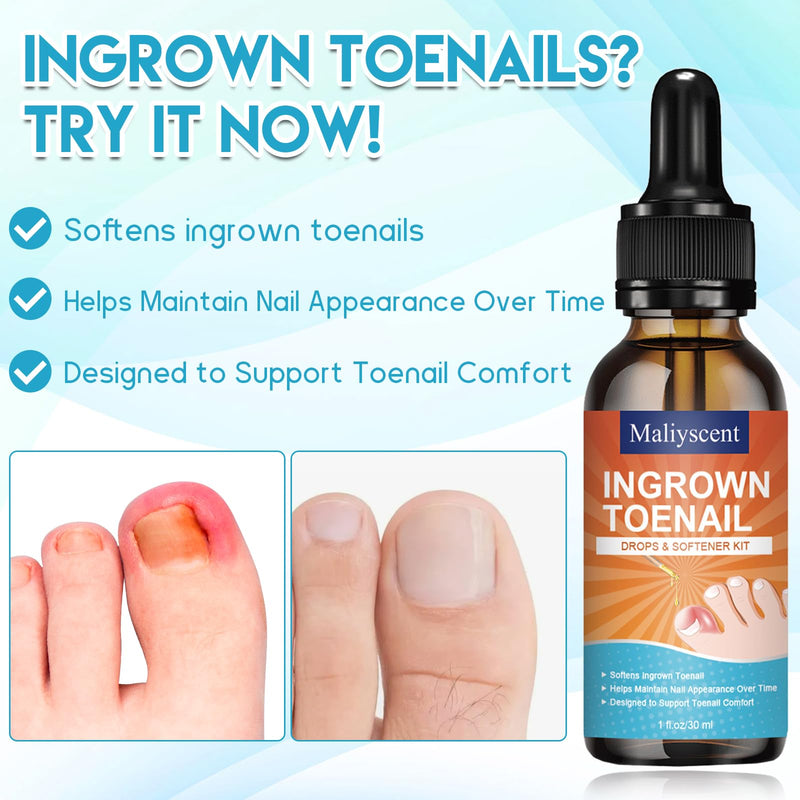 Ingrown Toenail Removal Kit, Professional Ingrown Toenail Tool Kit Includes Ingrown Toenail Corrector Drops, Corrector Patch, Toenail Clipper, Nail File Lifter Pedicure Tools - BeesActive Australia