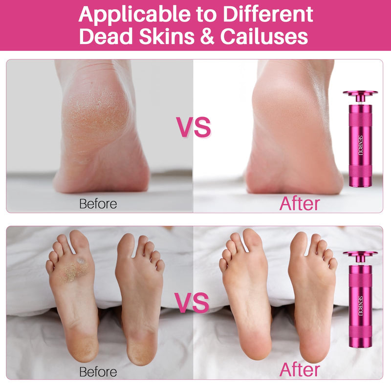 Electric Foot File Tool - Callus Remover for Feet, 2-in-1 Nail Grinder, Adjustable Speed with 60 Sandpaper Discs, Rose - BeesActive Australia