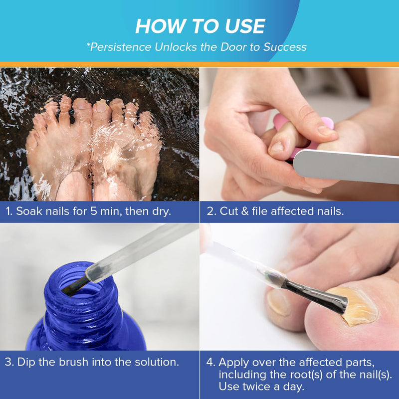 Toenail Fungus Treatment Extra Strength - Nail Fungus Treatment for Toenail - Toe Nail Fungus Treatment Extra Strength - Nail Fungus Treatment, 1 fl oz