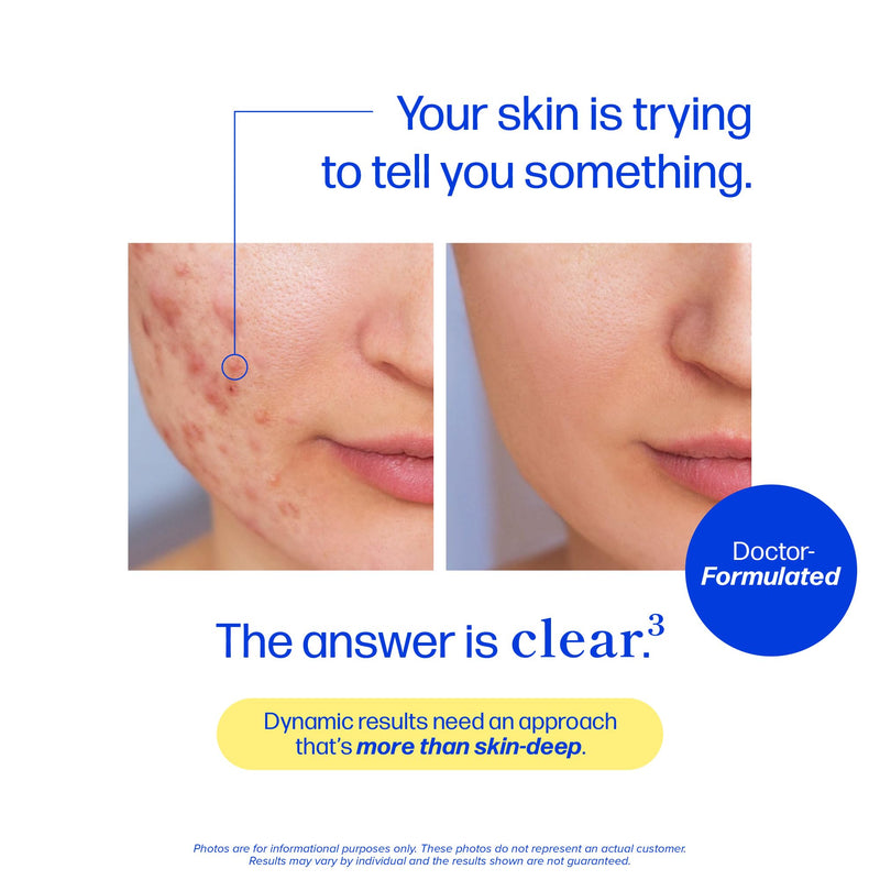 Clear Skin Supplement Acne Support, Zinc DIM, Probiotics, Doctor-Formulated | 3-in-1 Hormone, Gut & Complexion Support, Triple Action Hyaluronic Acid & Vitamins for Skin Balance and Glow, 60 Capsules 60 Count (Pack of 1)