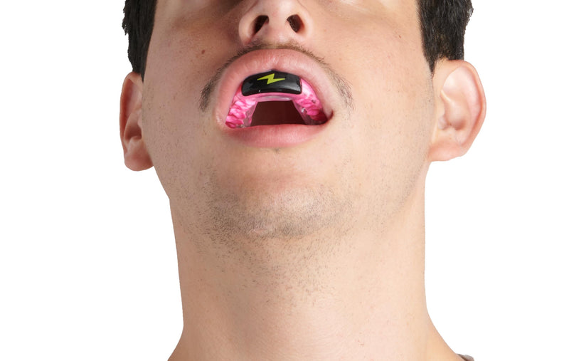Zone Mouthguard Sports Mouth Piece Starter Kit - Comfort-Fit Mouth Piece, Replacement Putty, & Carry Case. Comfort fit in Minutes. M.O.R.A. Technology. No Boil, No Pain for Youth (Pink) Pink - BeesActive Australia