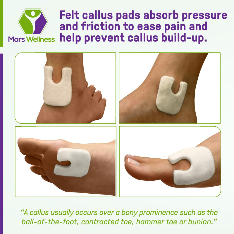 U Shaped Felt Callus Horseshoe Pads - Adhesive Foot Pads That Protect Calluses from Rubbing On Shoes - 3/16" - 25 Pack - BeesActive Australia