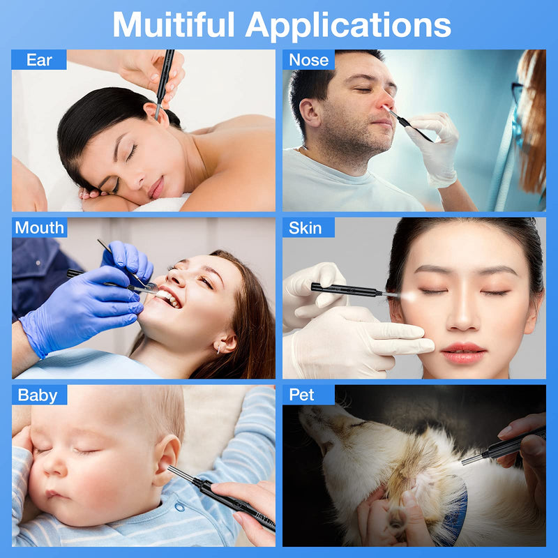 Ear Wax Removal with Camera, Earwax Remover Tool, 1296P FHD Wireless Ear Otoscope with 6 LED Lights, 6 Ear Spoon & 6 Traditional Tools Ear Wax Removal Kit for iPhone, iPad & Android Smart Phone - BeesActive Australia
