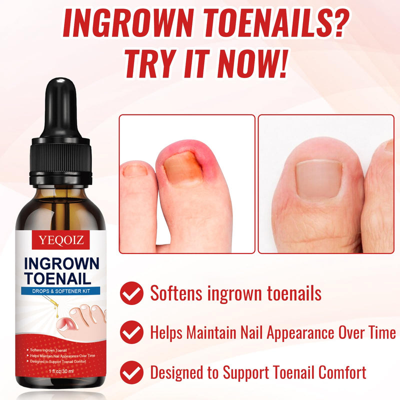 Ingrown Toenail Removal Kit, Ingrown Toenail Tool Kit with Ingrown Toenail Corrector, Ingrown Toenail Drops, Corrector Patch, Toenail Clipper, Nail File Lifter Tools - BeesActive Australia