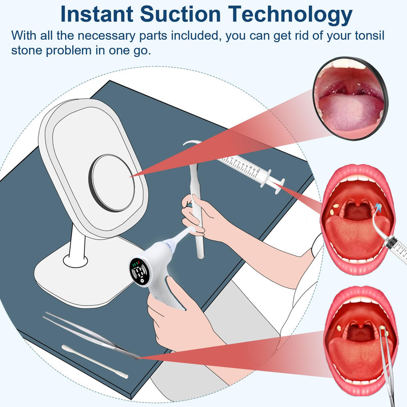 Upgraded Tonsil Stone Remover Tool, Upgraded Electric Tonsil Stone Removal Kit - with Built-in LED Light & 6-Level Suction for Bad Breath Prevention, Oral Suction Device for Stone Removal Ivory - BeesActive Australia
