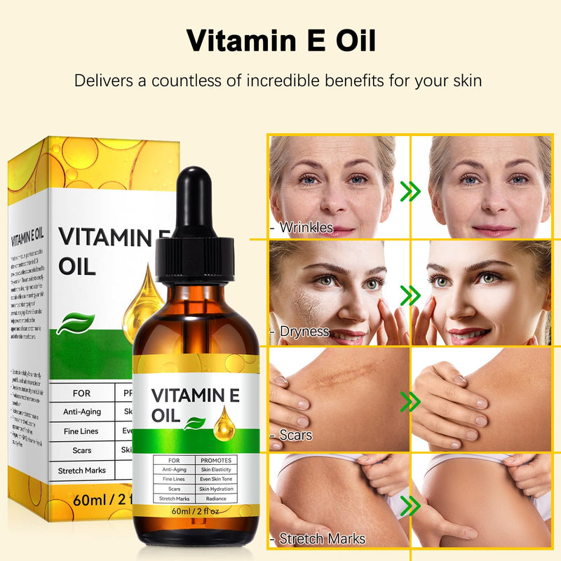 Vitamin E Oil for Skin, Hair & Scars - 75,000 IU, 100% Pure Natural Body Oil, Anti-Aging Face Moisturizer, Fades Stretch Marks, Nourishes Dry Skin & Nails, 4 Fl Oz 2