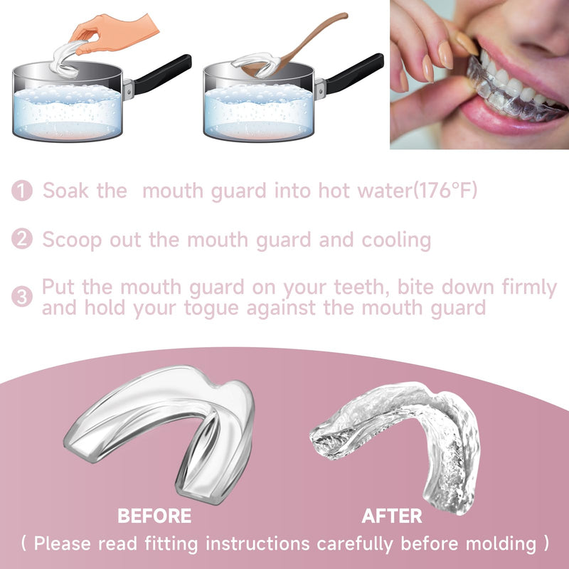 4 Pack Pink Kids Mouth Guard for Teeth Grinding,Comfortable Night Guard,Moldable Child Bite Guard for Clenching Teeth, Mouthguard for Kids - BeesActive Australia