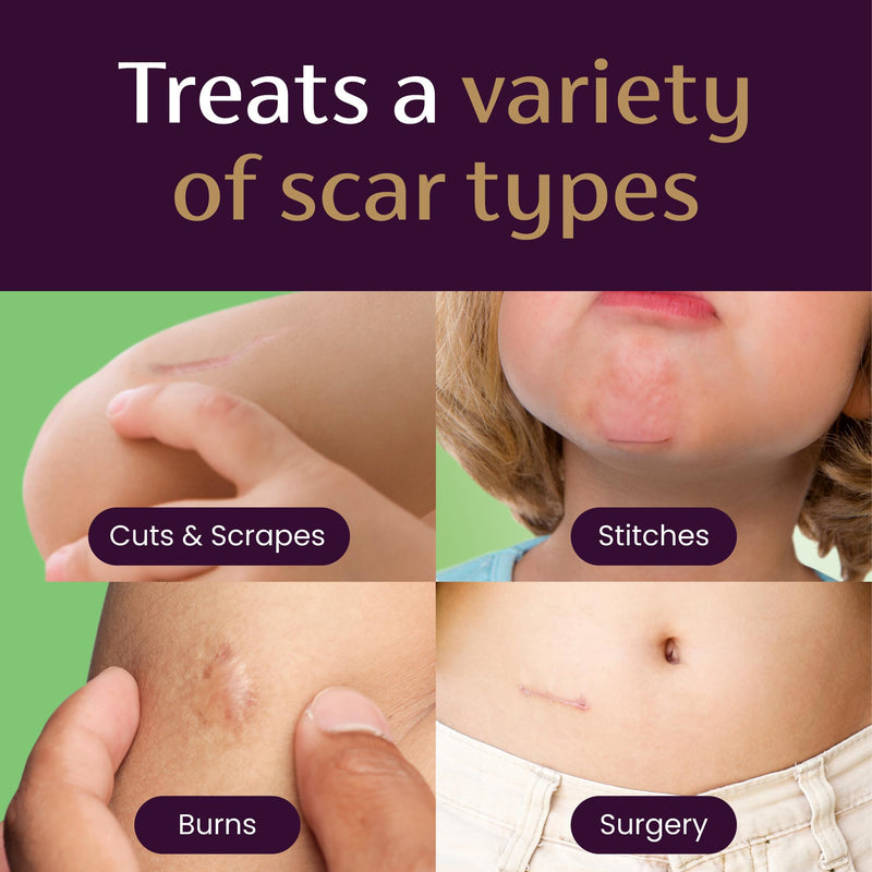 Mederma Scar Gel for Kids; Reduces the Appearance of Old and New Scars from Cuts, Burns, Surgery; Goes on Purple and Rubs in Clear; Grape Scented; Ages 2+, 40g (2 x 20g) Twin Pack - BeesActive Australia