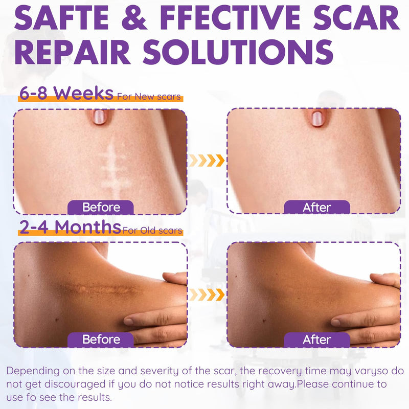 Silicone Scar Sheets, Silicone Scar Tape, Reusable Professional Scar Silicone Strips, Soft Silicone Scar Sheets for Surgical Scars,Keloid,Acne Scars,Burn Scar,C-Section (5M) 5M - BeesActive Australia