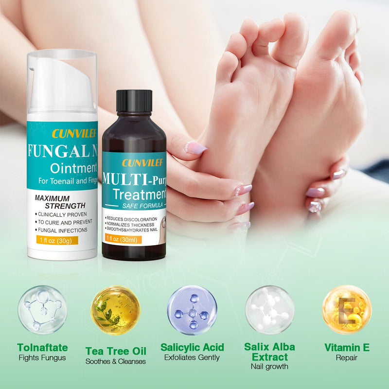 Toenail Fungus Treatment, 25% Undecylenic Acid Nail Repair Liquid 30ML & Clarus Tolnaftate 1% Toenail Fungus Cream 30g Set for Yellow toenails, Damaged Nail treatment extra strength with Tea Tree Oil 1 Fl Oz (Pack of 1)