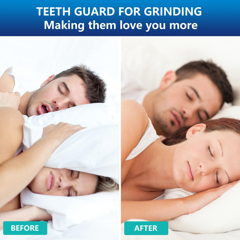Mouth Guard for Sleeping 4PCS with 12 Cleaning Tablets, Mouthguard for Grinding & Clenching Teeth at Night, Night Guards for Grinding of Teeth, Dental Bite & Boil Guard Clear - BeesActive Australia
