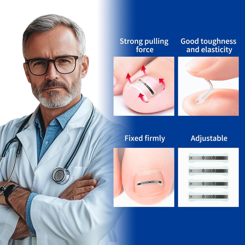 Ingrown Toenail Treatment, 10 packs Titanium Alloy Ingrown Toenail Corrector for all size foot, Ingrown Toenail Removal Kit for Curved Nail Repair, at Home Nail Kit Tools-Blue03