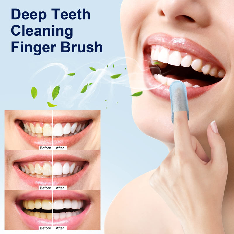 MySmile 100pcs Teeth Wipes Disposal Finger Brush Deep Cleaning Teeth Wipes Oral Brush Up Tooth Wipes for Teeth Cleaning, Mint Flavor Blue - PawsPlanet Australia