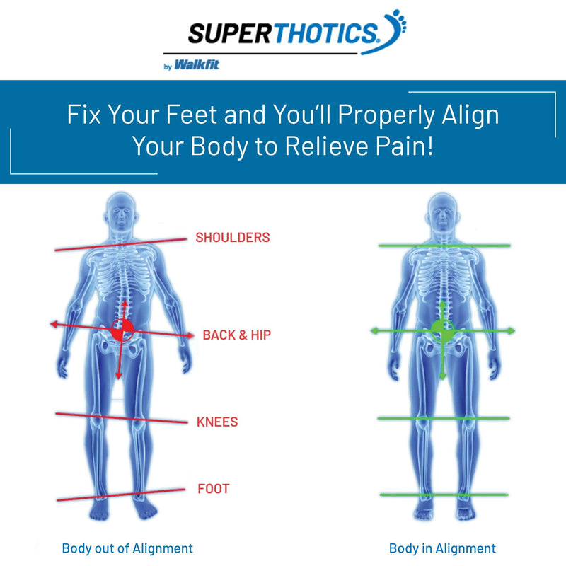 Superthotics by WalkFit | Customizable Orthotic Inserts Arch Support Shoe Insoles for Men & Women, Align The Body to Relieve Plantar Fasciitis, Foot, Hip, Knee & Back Pain (Women's 8.5-10) Women's 8.5-10