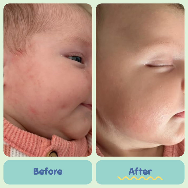 TUBBY TODD All Over Ointment - Baby Eczema Cream, Everyday Multi-Purpose Sensitive, Dry, Irritation Baby Skin Relief Cream, Steroid & Gluten Free, Fragrance Free, 3.5 oz & 8oz, 2 Pack 2 Pack - 3.5 Ounce & 8 Ounce - BeesActive Australia