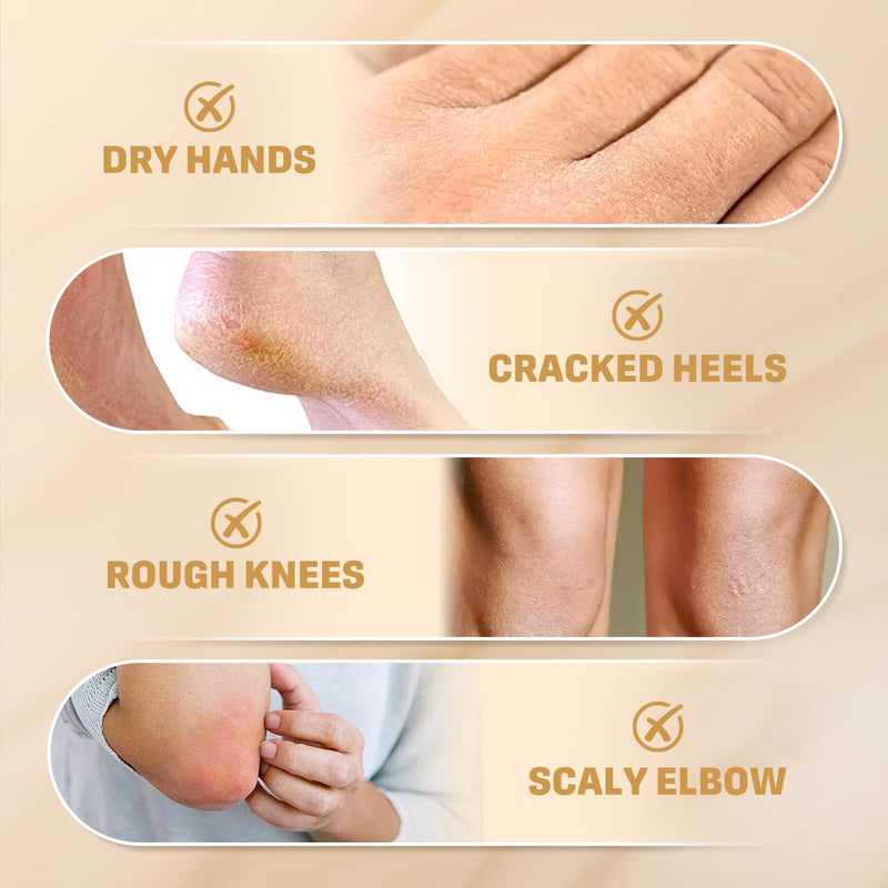 60% Urea Cream with 2% Salicylic Acid, Urea Cream 60 Percent for Feet & Hands- Maximum Strength Moisturizer for Rough, Dry, Thick & Cracked Skin, Callus Remover, Deep Hydration, 150g 5.29 Ounce (Pack of 1) - BeesActive Australia