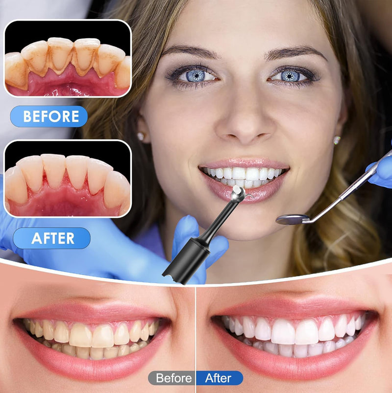Tooth Polisher,Teeth whitening kit 12 Pieces Accessories，Teeth Polishing Kit for Daily Cleaning,Polishing Then Whitening kit - BeesActive Australia