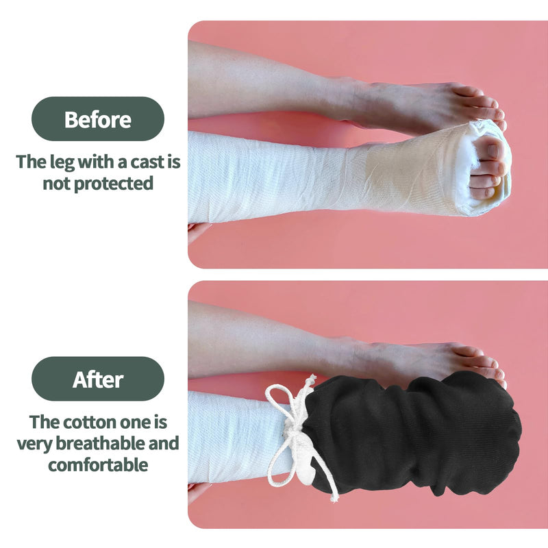 Cast Sock Cover for Foot, Cast Cover for Foot, Leg Cast Cover, Adjustable Drawstring Foot Cast Cover for Men and Women (Thick, Black) 14 Inch Thick, Black
