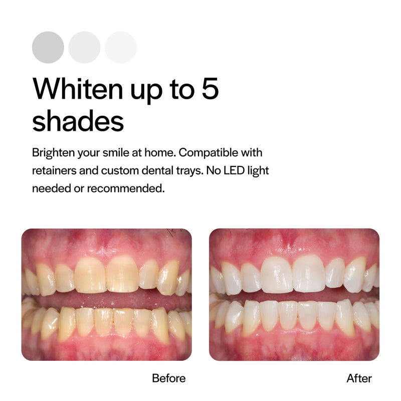 Opalescence 10% Teeth Whitening Kit - Gel Syringes Refills - Low Sensitivy (8 Units) - Fluoride, Carbamide Peroxide - Made in The USA by Ultradent 5211-4 - BeesActive Australia