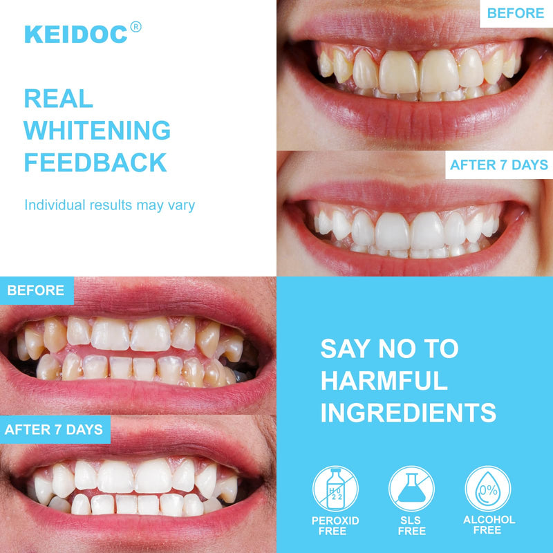 Teeth Whitening Strips - 14 Treatments Enamel-Safe Natural Coconut White Strips for Teeth Whitening, Non-Sensitive, Mint, 28 Strips Dry Strip - BeesActive Australia