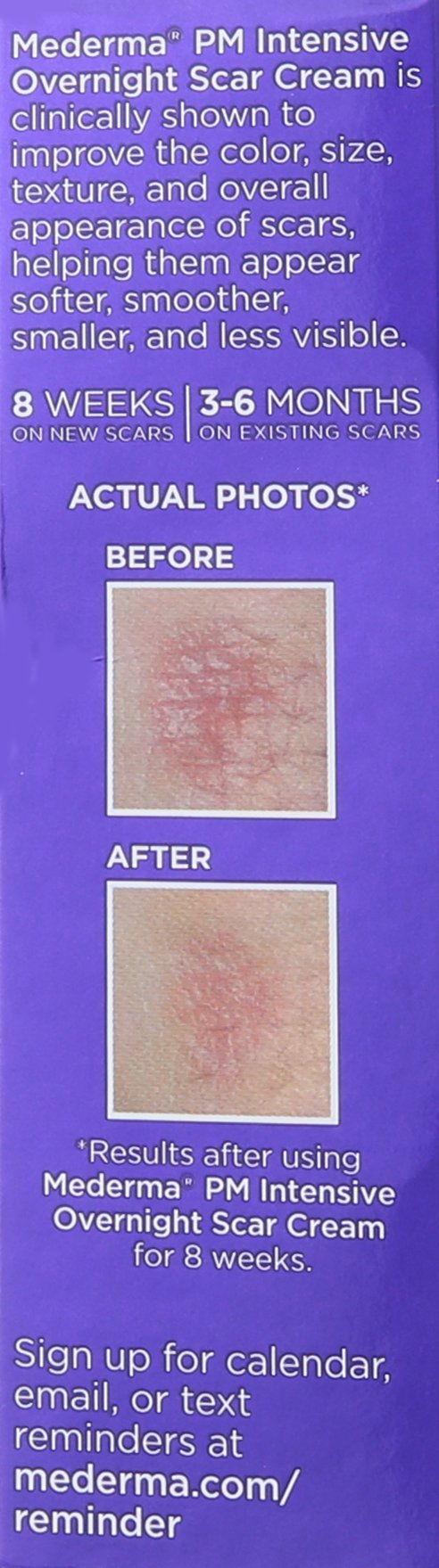 Mederma PM Intensive Overnight Scar Cream - Works with Skin's Nighttime Regenerative Activity - Once-Nightly Application is Clinically Shown to Make Scars Smaller & Less Visible - 1 Ounce, Beige (302591302106) Old Label - 1 Ounce (Pack of 1)
