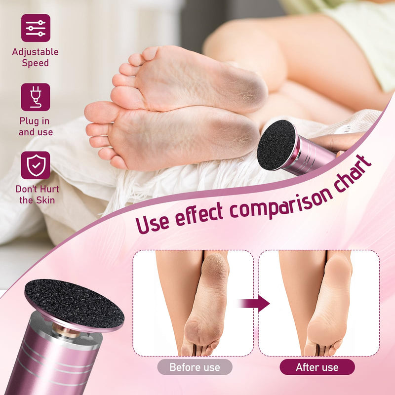 krofaue 1000RPM Electric Foot Callus Remover - Stepless Speed Control Foot Sander with 60pcs Replacement Sandpaper Disk, Electric Foot File Professional Pedicure Tool for Women Dead Cracked Hard Skin - BeesActive Australia