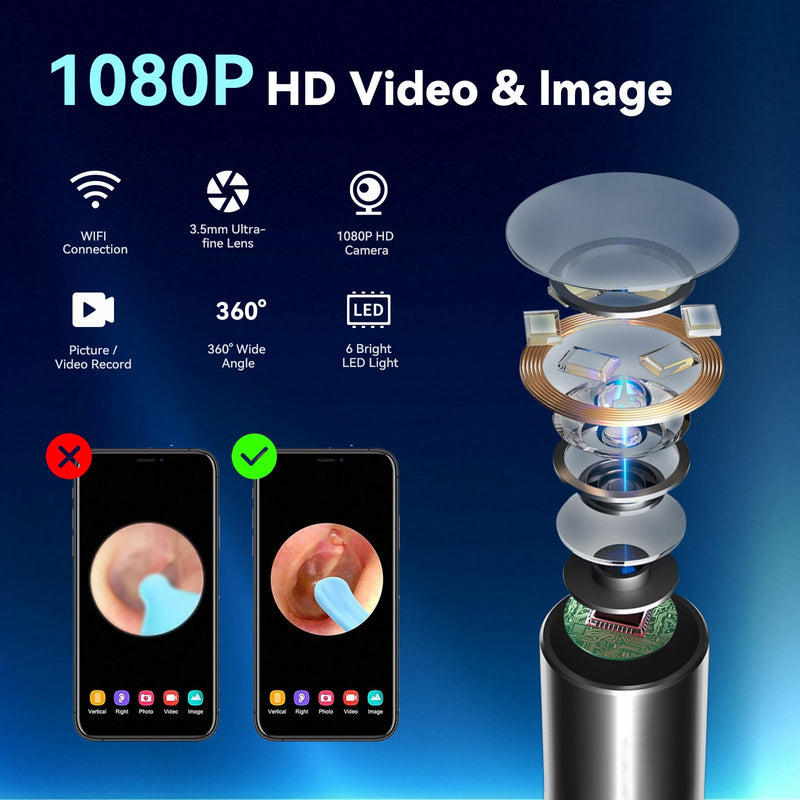 1080P HD Ear Camera with 6 LED Lights - Waterproof Rechargeable Otoscope Tool, Ear Wax Removal Kit with 8Pcs Ear Care Set for iOS & Android Ear Cleaner A - BeesActive Australia