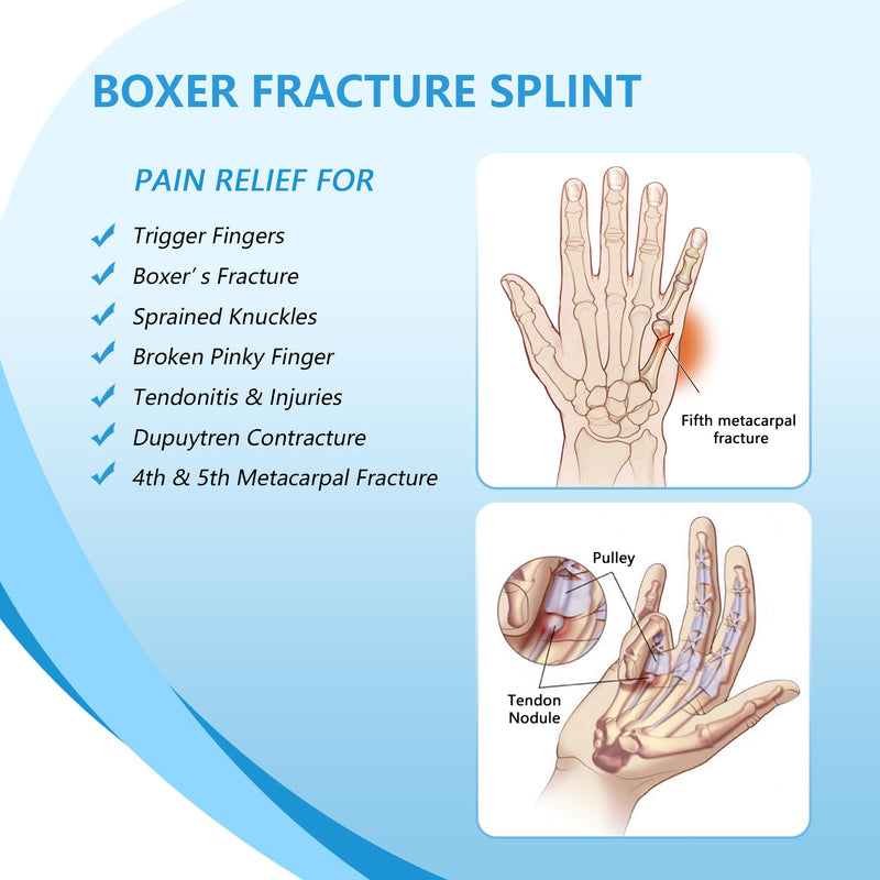 Pinky Finger Splint, Boxer Fracture Splint, Metacarpal Splint for 4th or 5th Finger, Finger Splint for Broken Finger Trigger Finger Arthritis Tendonitis,Fits for Left & Right Hand(Mesh,S/M) Mesh S/M