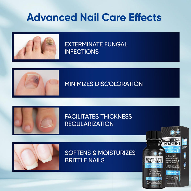 Fungus Treatment for Toenails, Toe Nail Fungus Treatment Extra Strength, Toenail Fungus Treatment, Fast Acting - 2 Packs, Black Scent 0.5 Fl Oz (Pack of 2)