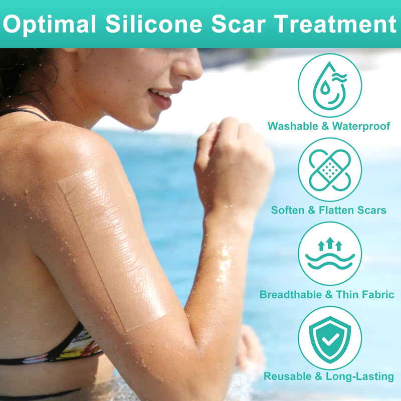 Silicone Scar Sheets(1.6” x 120” Roll-3M), Reusable Silicone Scar Tape for Surgical Scars, C-Section Scars, Stretch Marks, Hypertrophic Scars, Burn Scars, Tummy Tuck and Keloid Scars - BeesActive Australia