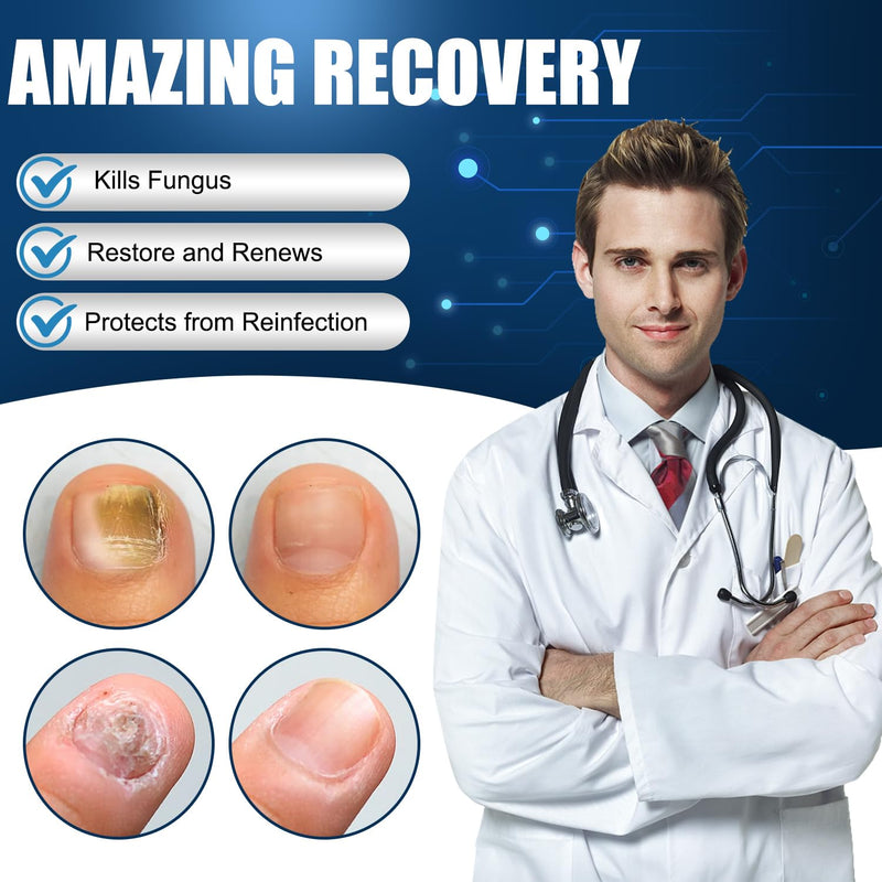 Toenail Fungus Treatment Extra Strength,Nail Fungus Treatment for Toenail,Fungus Nail Treatment Liquid 30ML and Fungal Nail Repair Cream.
