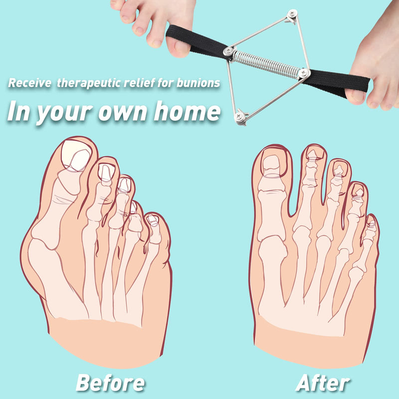 Pilates Toe Stretcher Bunion, Hallux Valgus Big Toe Strap Spacer Tension Bunion Exercise Band Stretchy Alignment Splint Restores Pain Relief for Women Men (Pack of 2) One Size (Pack of 2)