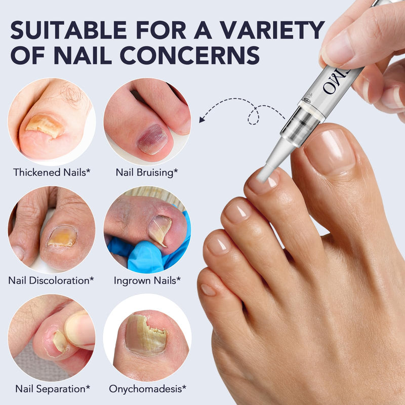 Toenail Fungus Treatment Extra Strength, Nail Fungus Pen, 25% Undecylenic Acid with added Tea Tree Oil, Jojoba, Clove Bud Oils & Aloe, Fast-Acting Solution for Toe & Fingernail Fungi, 5PCS blue