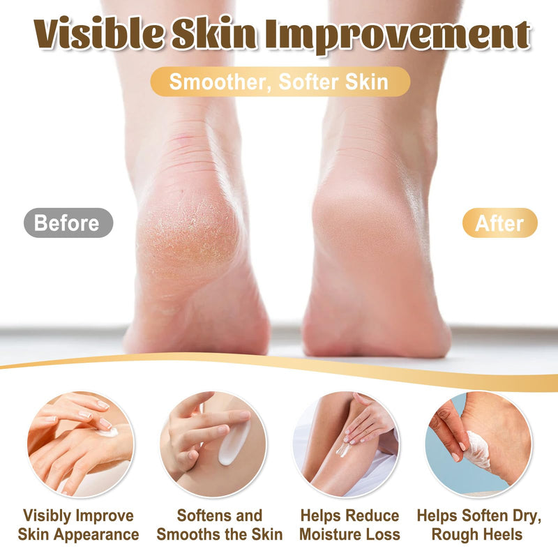 40% Urea Cream for Feet – Maximum Strength Foot Cream for Dry Cracked Heels & Calluses, Deep Softening Heel Repair, Urea Lotion for Body Hydration, Fast-Absorbing Foot Moisturizer for Rough Skin - BeesActive Australia