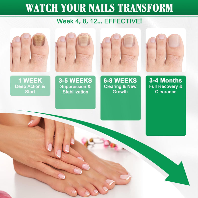 Toe Nail Fungus Renewal Pen, Toenail Fungus Renewal, 3 Packs Powerful Fast Acting For Thick, Discolored, Broken & Damaged Toe & Finger Nail 0.4 Fl Oz (Pack of 1)