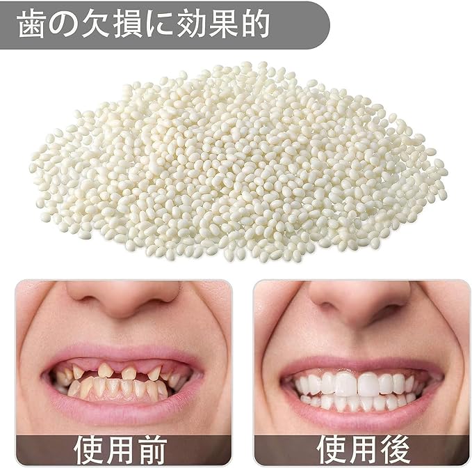 ShuaWdk Thermoplastic Resin Soft Plastic Crystal Clay DIY Consumables Funny Beads Thermal Beads Plastic Particle Repair Melting Beads Repair Multiform Pellets Can Be Used Over and Over (5g) - BeesActive Australia