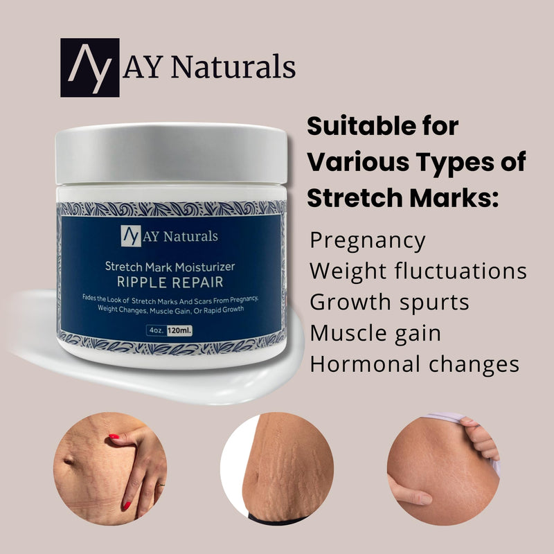 Ripple Repair: Stretch Mark and Scar Cream | Reduces Stretch Marks and Scars from Pregnancy, Weight Changes and Muscle Growth | 4 oz. - BeesActive Australia