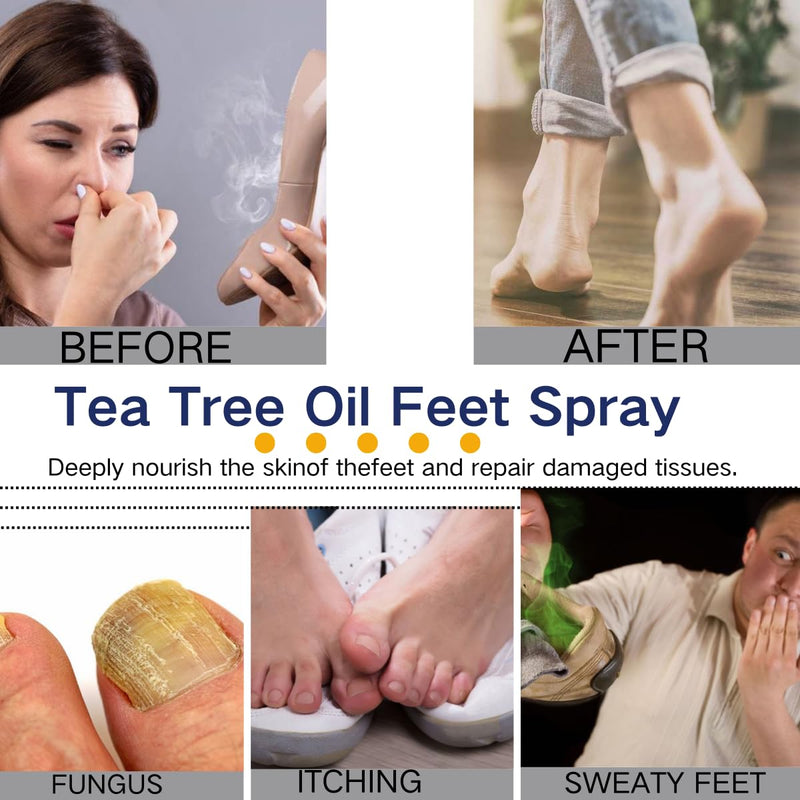 2PCS Foot Spray with Tea Tree Oil,Tea Tree Oil Feet Spray,Foot & Shoe Freshness,Quick-Drying and Travel-Friendly - BeesActive Australia