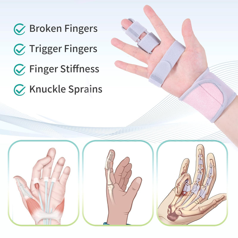 lefeke Trigger Finger Splint, Finger Brace for Middle, Index, Pinky or Ring Finger Support, Hand Splint for Broken Fingers, Arthritis, Fracture, Hand Brace with Fingers Support (Pink) Pink
