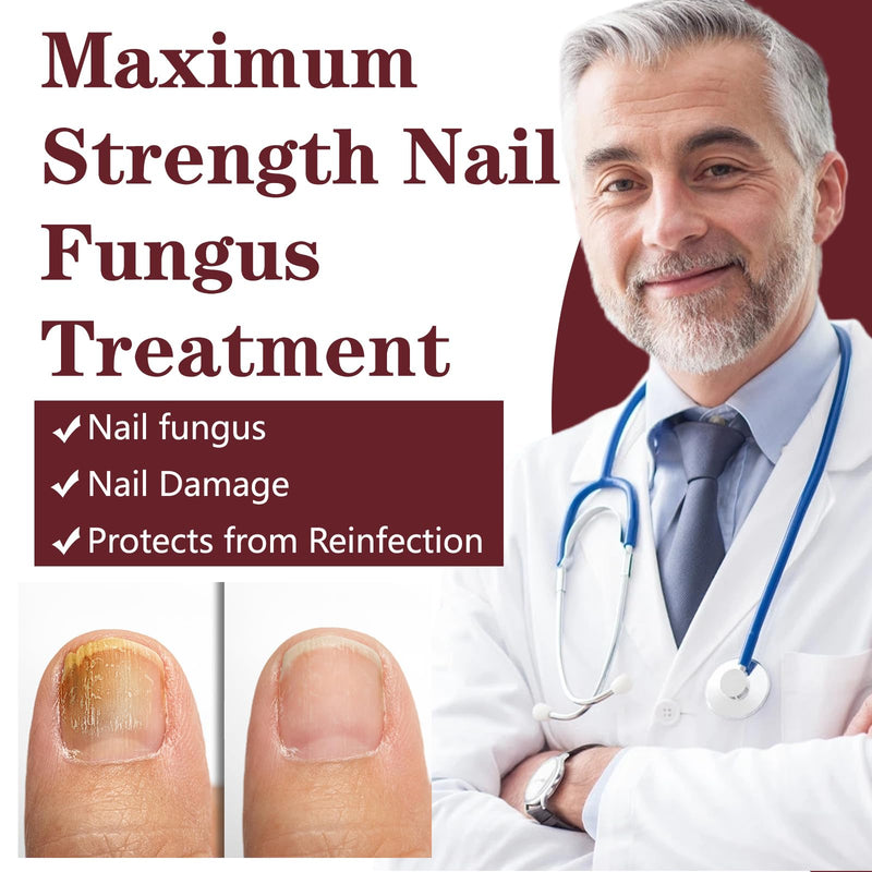 Toenail Fungus Treatment Extra Strength, Nail Fungus Treatment for Yellow, Thick, Discolored, Broken Nails, Ultimate Fungal Nail Repair, Make Nails Look Healthier Stronger, 2 Bottles - BeesActive Australia
