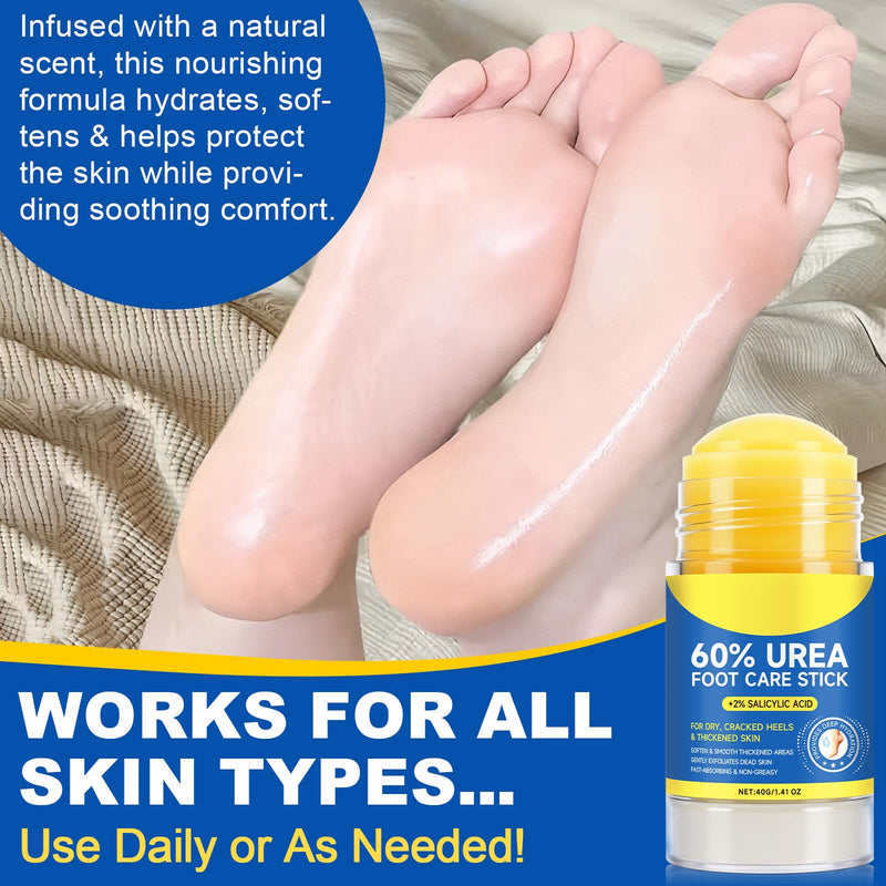 60% Urea Cream Stick plus 2% Salicylic Acid, Maximum Strength Urea Foot Cream Callus Remover for Dry Cracked Heels, Hands, Knees,Exfoliating Moisturizer, Dead Skin Remover Foot Balm 1.4oz (2pcs) 1.41 Fl Oz (Pack of 2) - BeesActive Australia