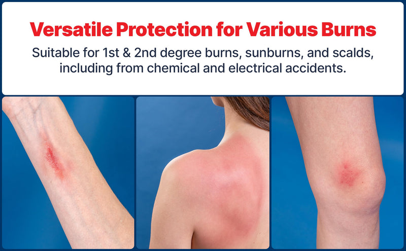 BurnFix¬Æ Hydrogel Burn Spray ‚Äì 120 ml Instant Cooling Relief for 1st & 2nd Degree Burns, Sunburns & Scalds | Doctor-Recommended Moisturizing First Aid Essential for Kids & Adults 1