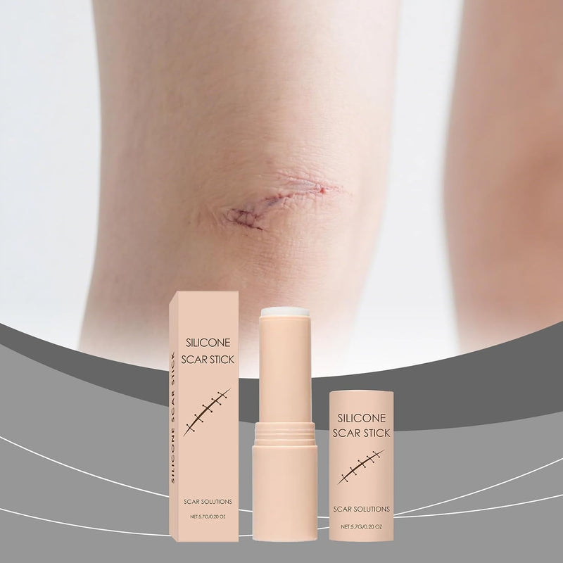 Scar Stick, Scar Solutions Silicone Scar Stick, Thick Solid Velvety Film for Old, Burn Scars, Acne, Stretch Marks, Formula Infused with Asiatica Extracts and Vitamin E for Skin Smoother, Softer