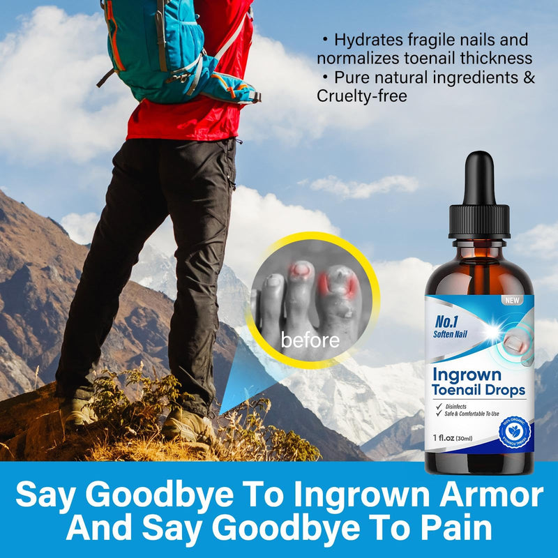 Ingrown Toenail Treatment, Ingrown Toenail Corrector Drops, 30ml Fast-Acting Ingrown Toenail Softener & Care Solution, Plant-Based Formula for Easier Trimming, Gentle for All Ages 1 Fl Oz (Pack of 1)